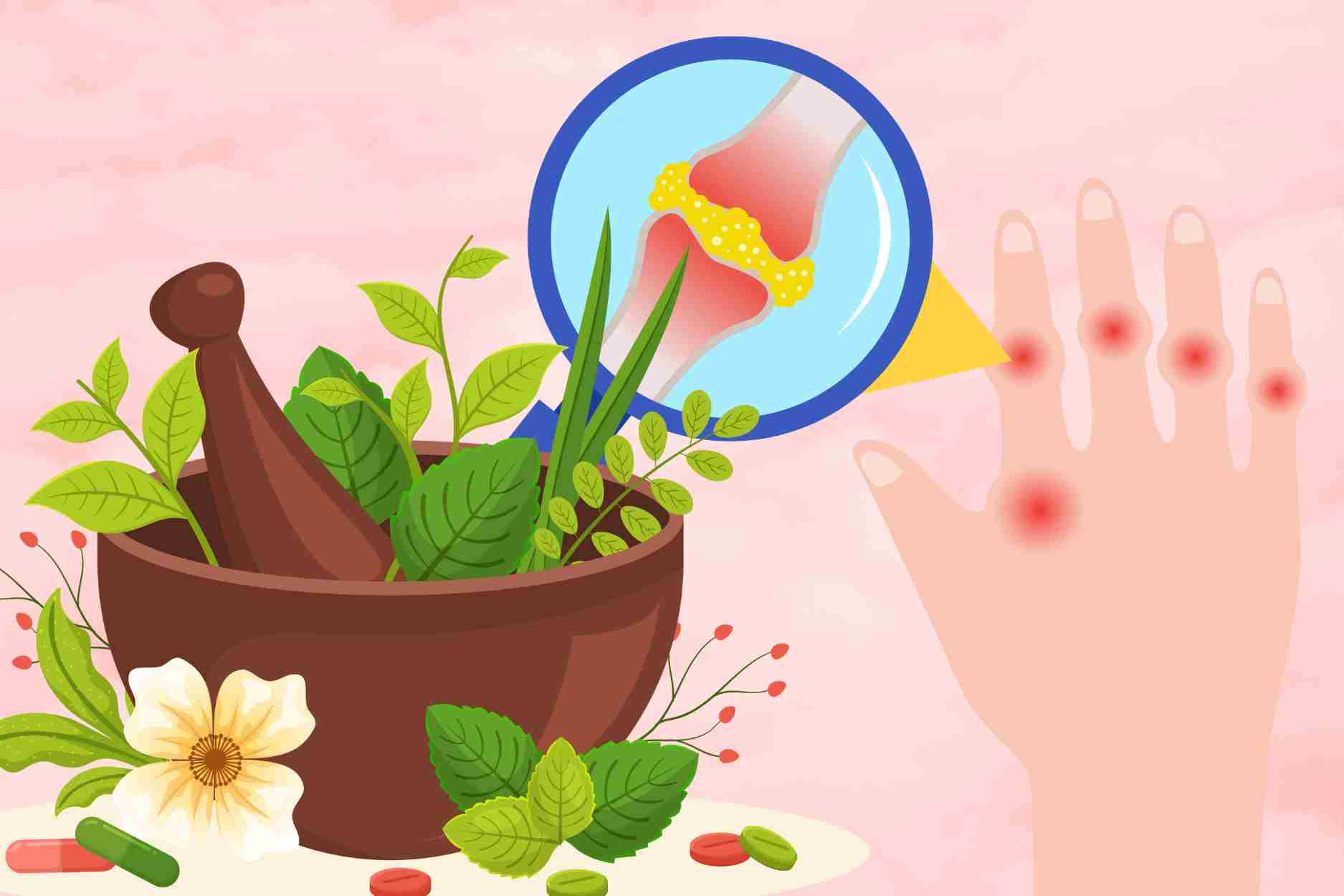 3 hierbas que ayudan a reducir el acido urico y prevenir la recurrencia de la gota