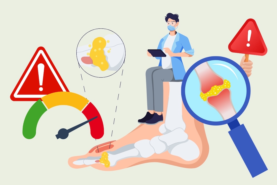 Errores comunes al controlar el acido urico en casa en invierno