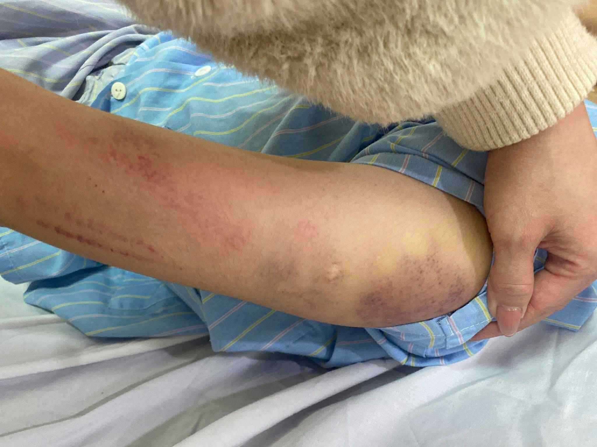 Cong an da vao cuoc xac minh nguyen nhan su viec chau be nhap vien. Anh: Ngoc Anh