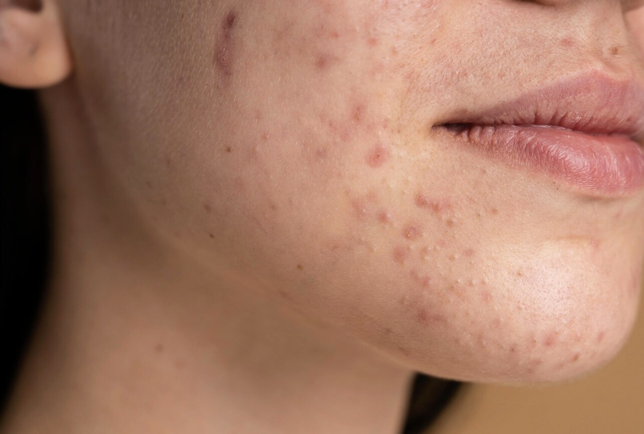 Winter causes dry, itchy, and flaky skin. Photo: Thuy Duong