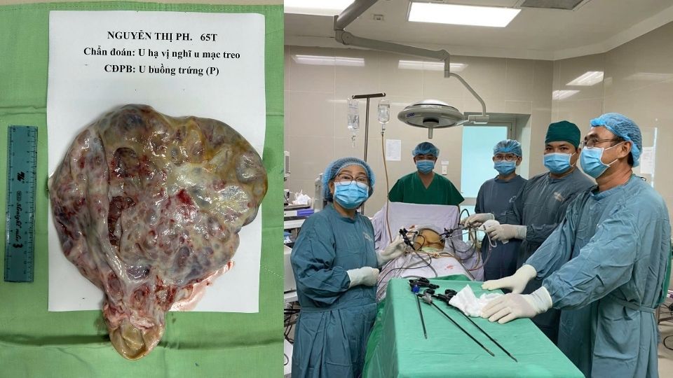 Equipo del Departamento General de Cirugia del Hospital General de Vinh Long realiza una cirugia endoscopica. Foto: Hoang Loc