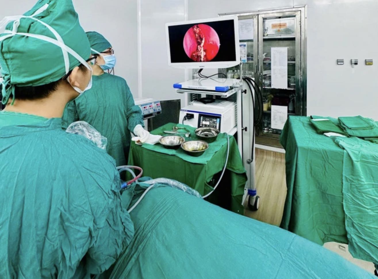 Doctors in Khanh Hoa have just performed an endoscopy and removed a calcium foreign object that had existed for many years in the patient's nose. Photo: Provided by the hospital