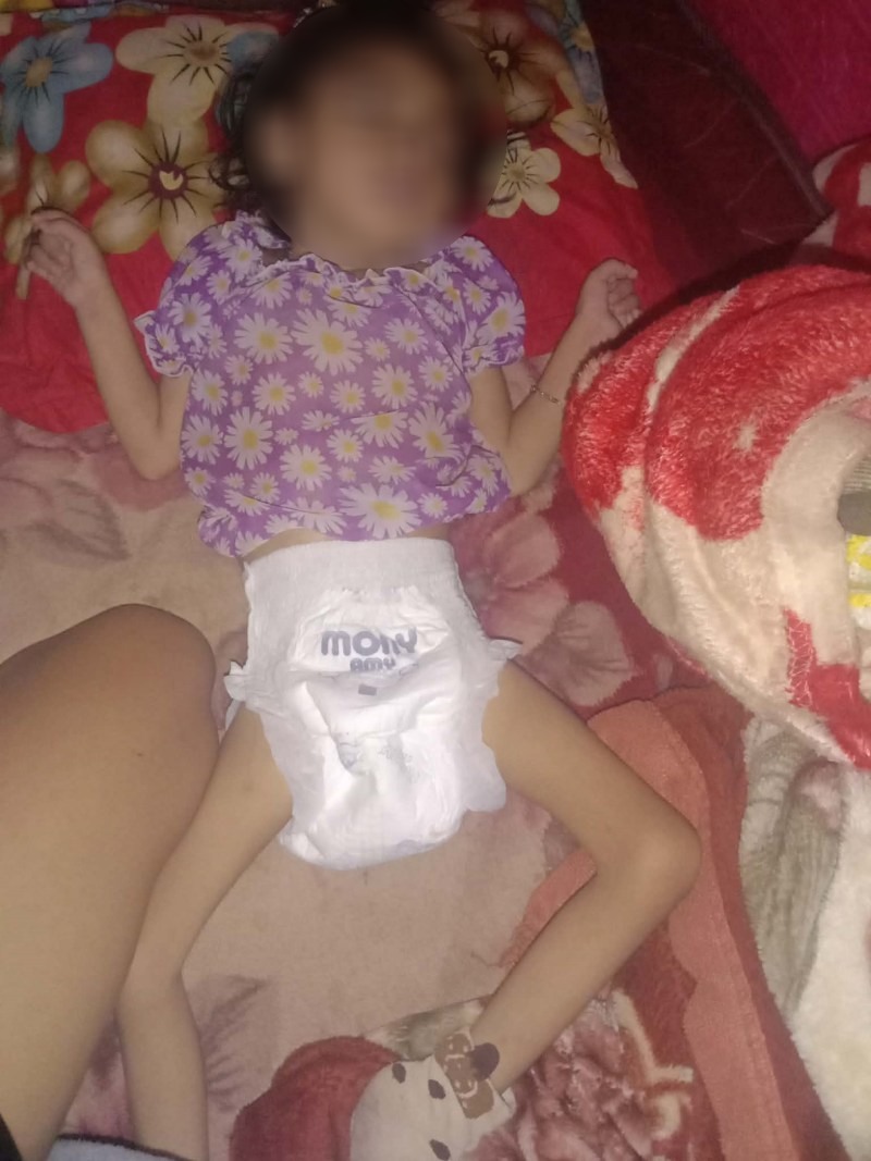 Be H Beny Eban khong chi bi bai nao ma con mang trong minh nhieu can benh khac. Anh: Nhan vat cung cap