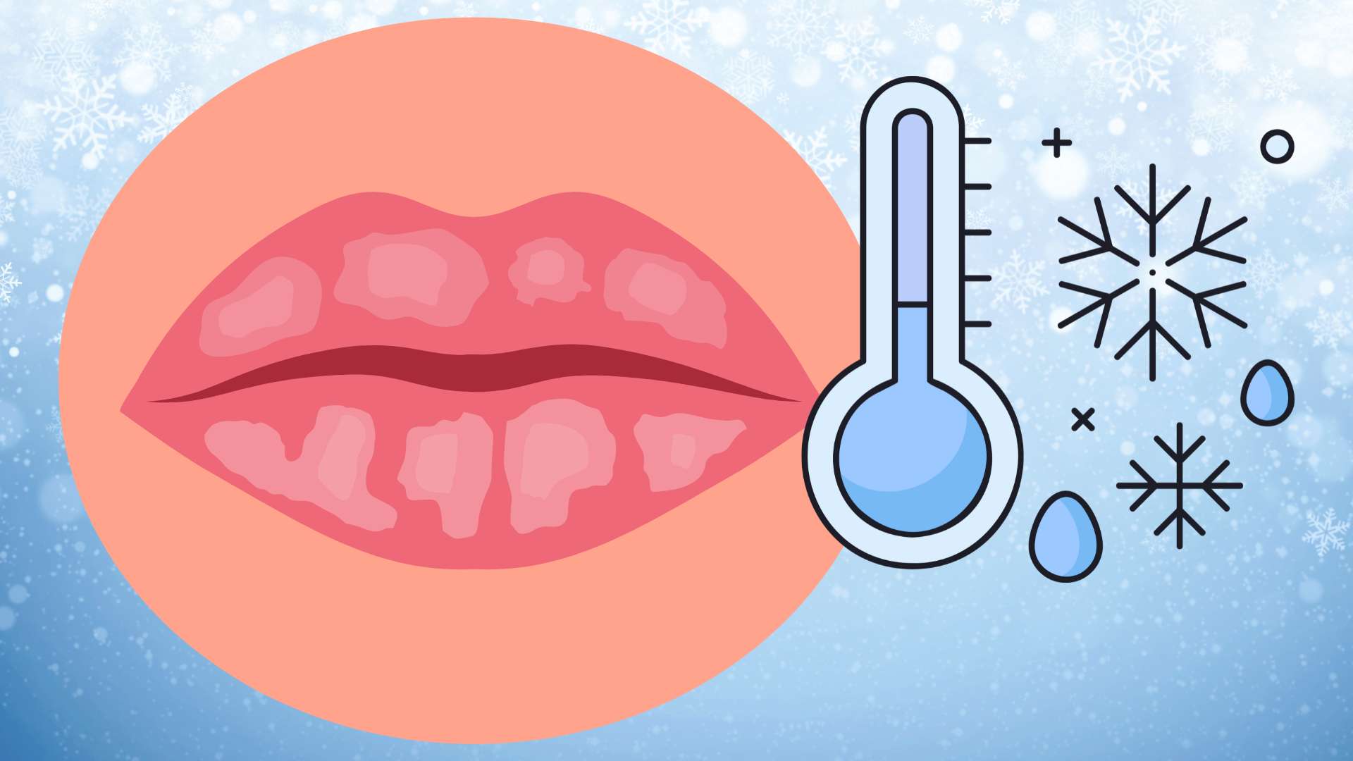 Peeling nose in winter, you should not ignore these 3 ways