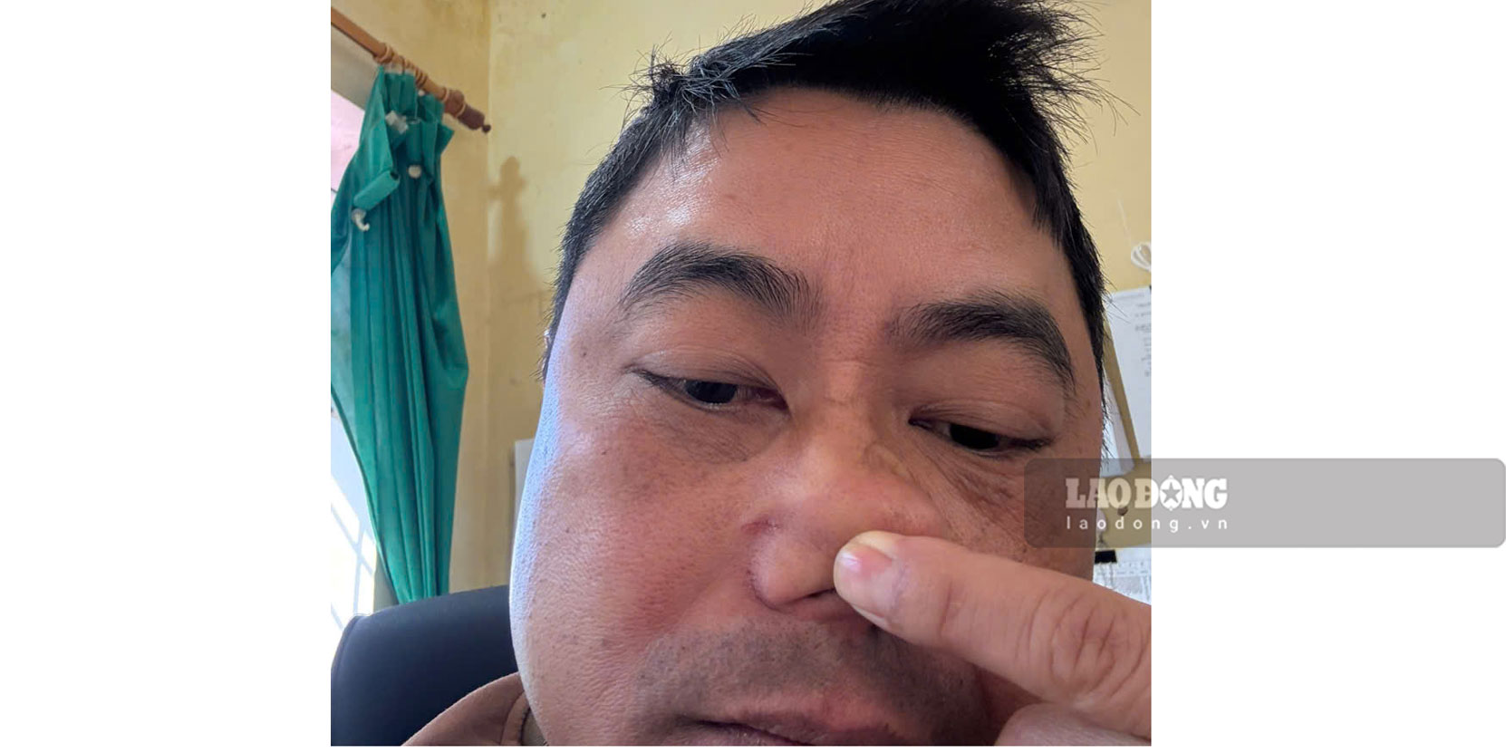 Ong Nguyen Van Thanh - Hieu truong nha truong cho rang minh bi danh truoc va cung bi thuong o mui. Anh: Duy Dung