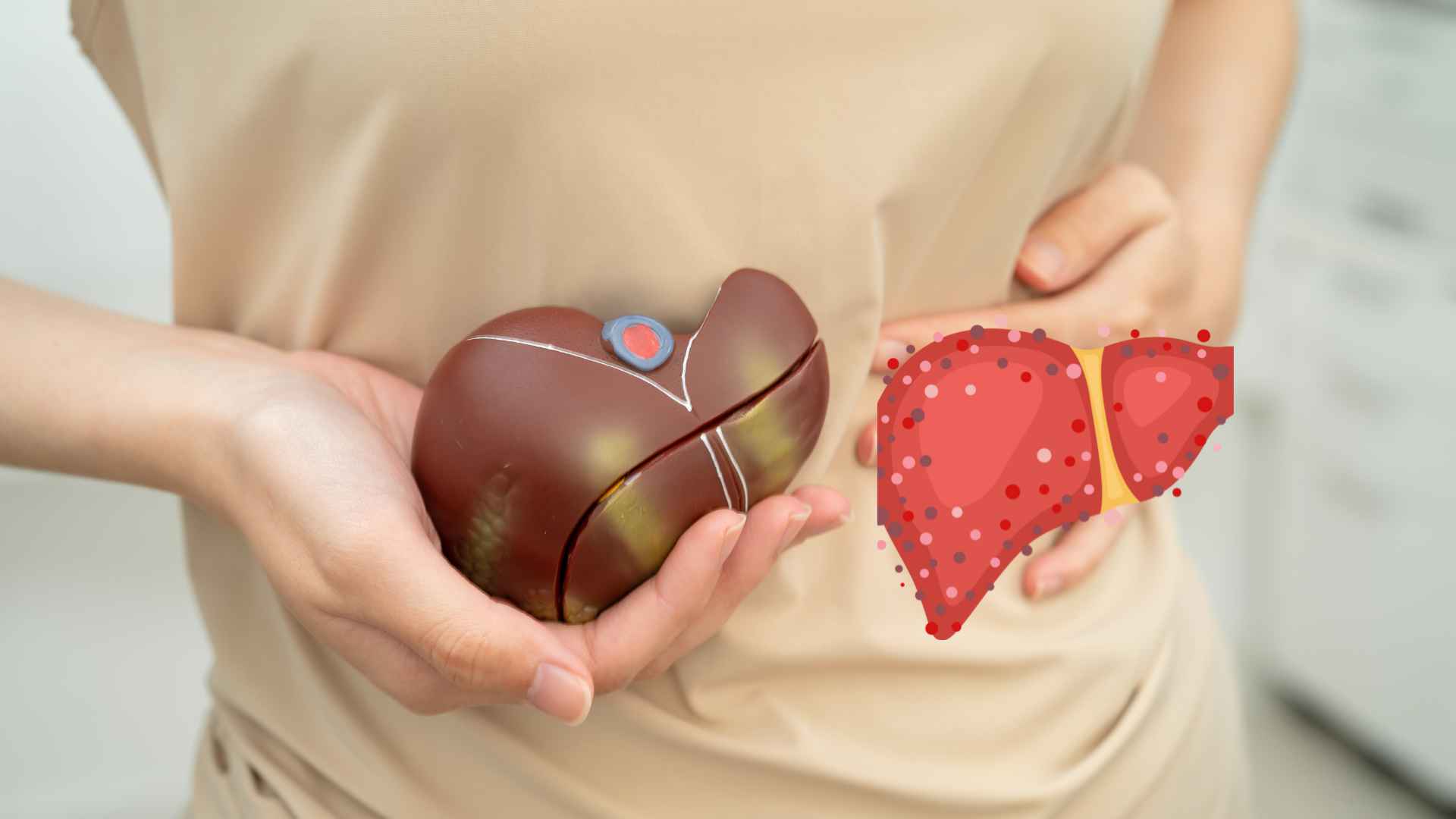 Alcohol and alcoholic beverages are not good for people with increased liver enzymes. Graphic photo: Huong Son