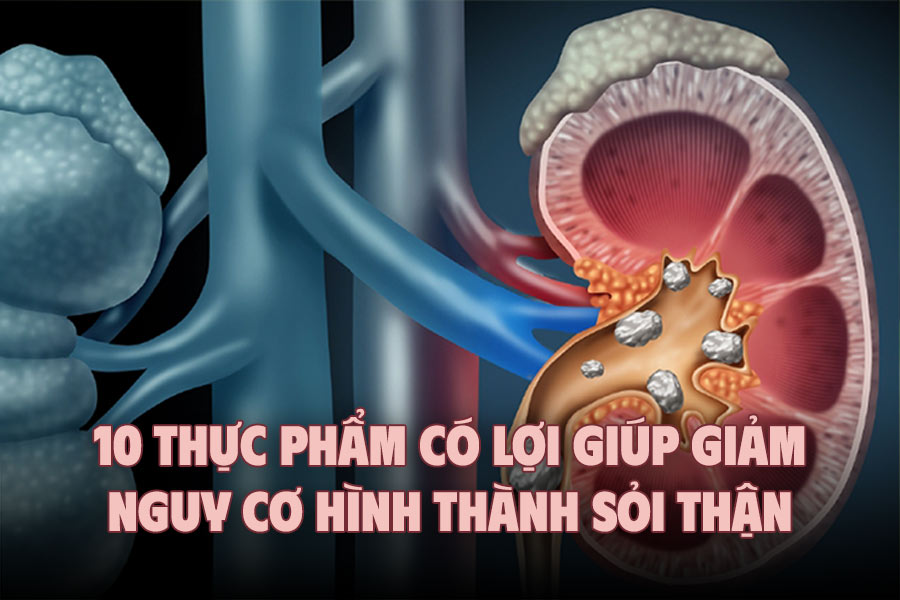 10 beneficial foods to help reduce the risk of kidney stones formation