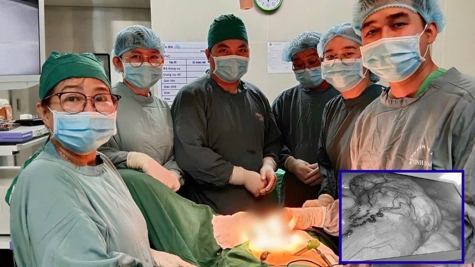 빈롱 종합병원 의사팀은 동시에 소장 GIST 종양과 대장암을 앓고 있는 환자에게 내시경 수술을 시행했습니다. 사진: 빈롱 종합병원.