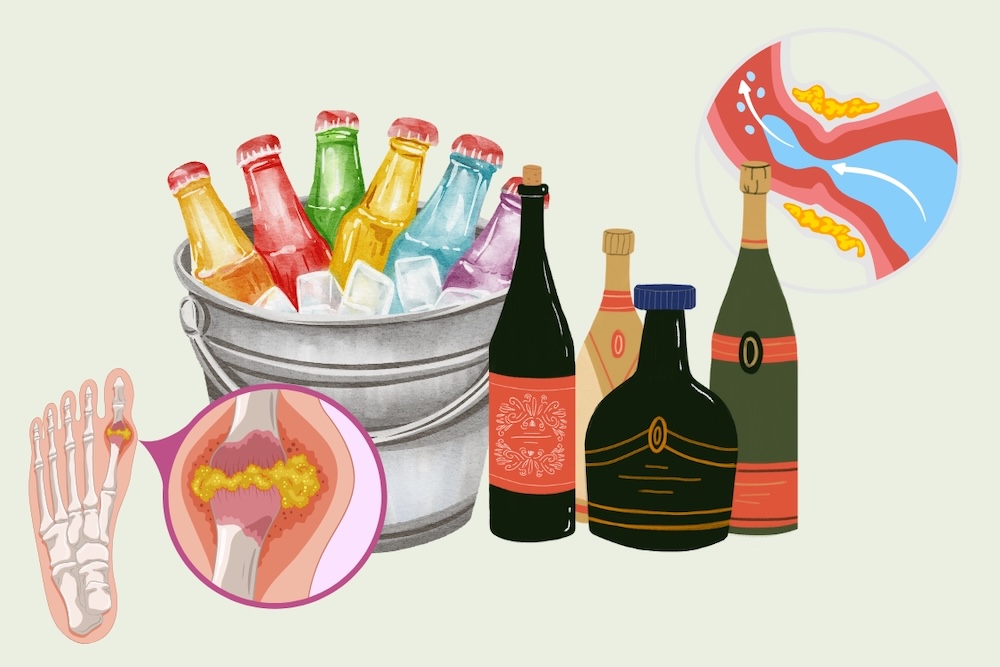 4 types of drinks that can increase the risk of gout