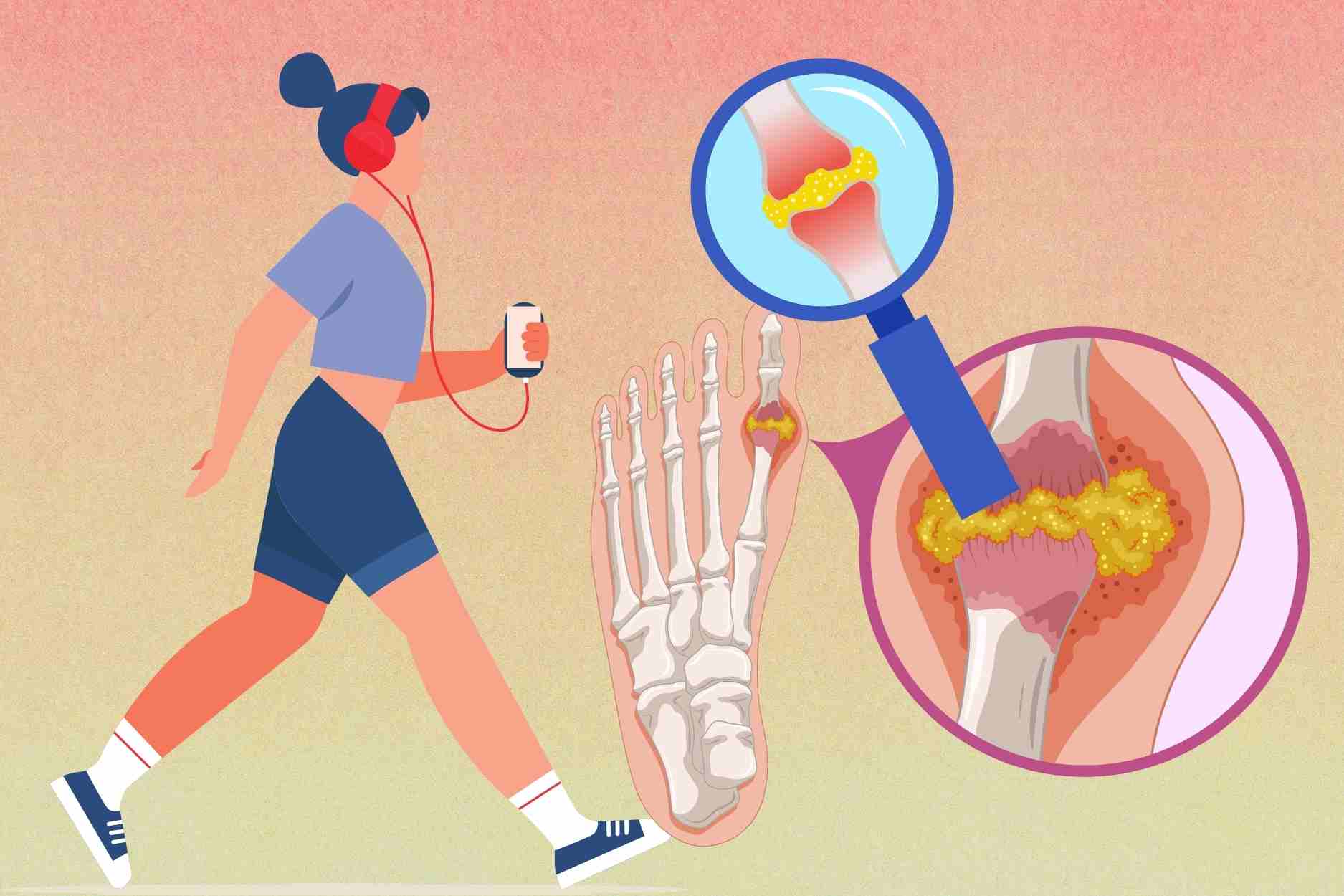 Benefits of slow walking in cold weather for people with high uric acid