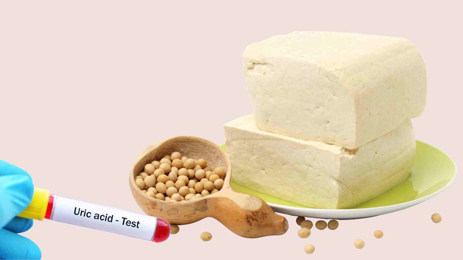 適度な玉ねぎを食べると、尿酸値が上昇しません。グラフィック:Ha May