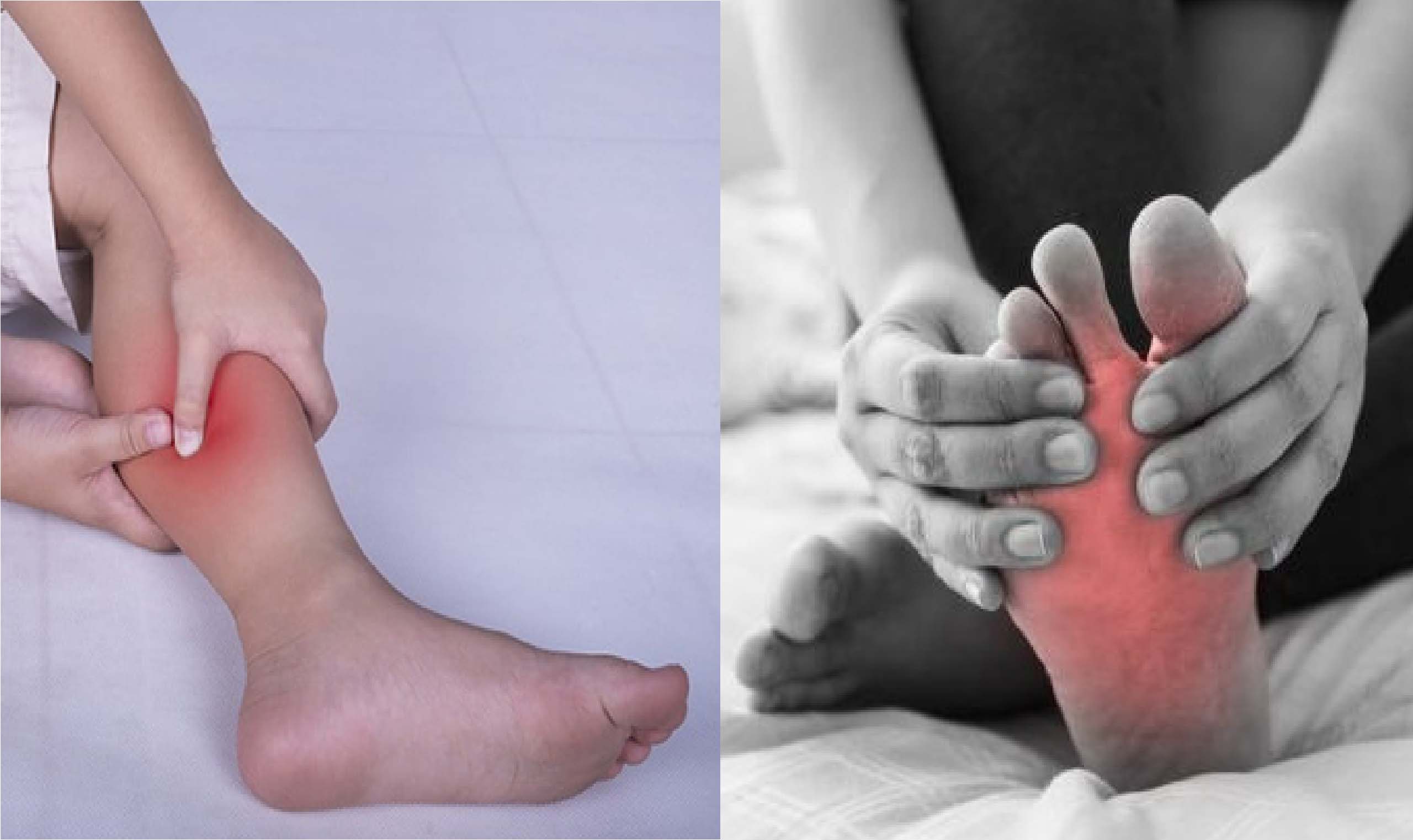 많은 장기간 발목 마비 사례는 정맥 부전 또는 말초 동맥 질환과 관련이 있습니다. 그래픽: Minh Quang