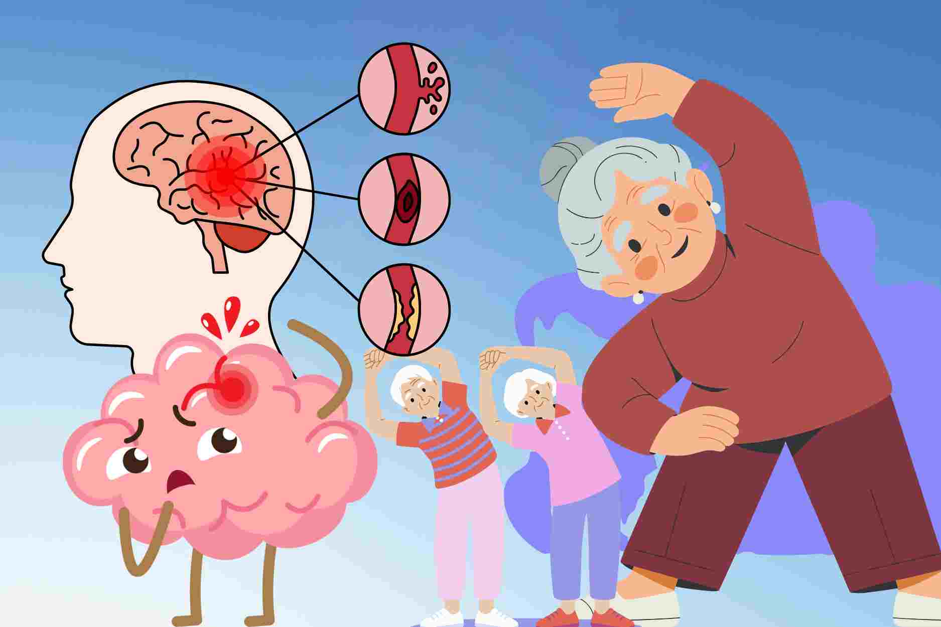 3 habits of exercise that easily increase the risk of stroke