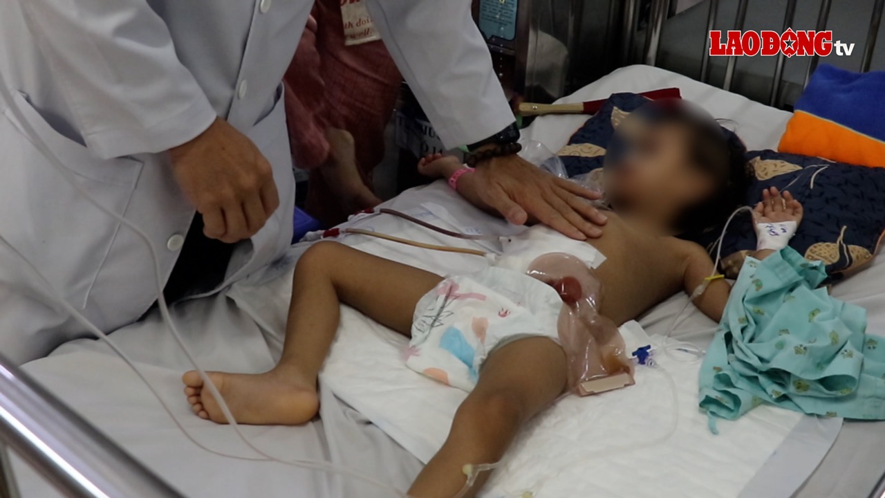 Pediatric patients in Ho Chi Minh City are susceptible to EV71 infectious diseases and hand, foot and mouth disease. Photo: Nguyen Ly