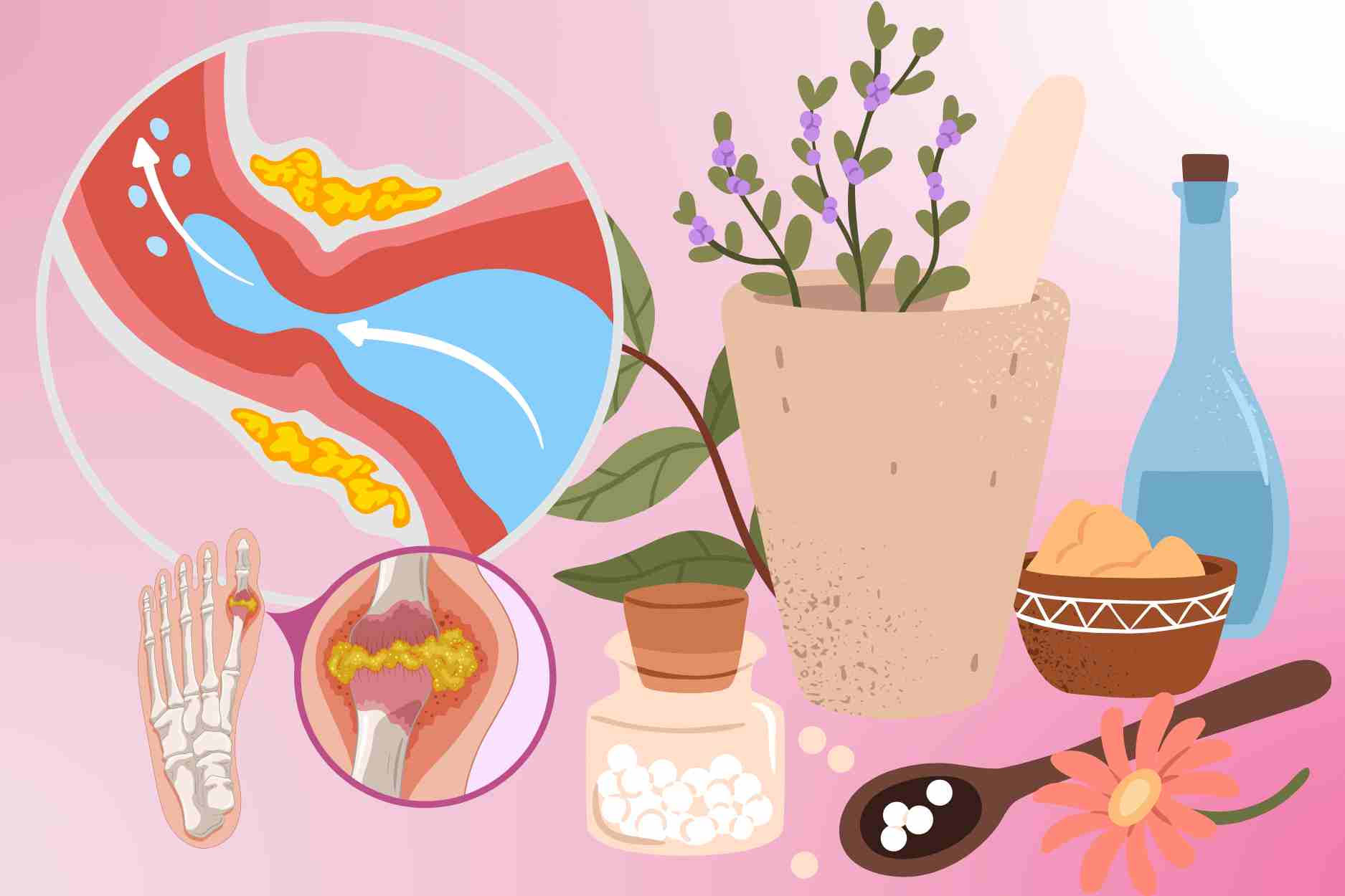 Natural aloe vera helps reduce uric acid and effectively soothe gout pain