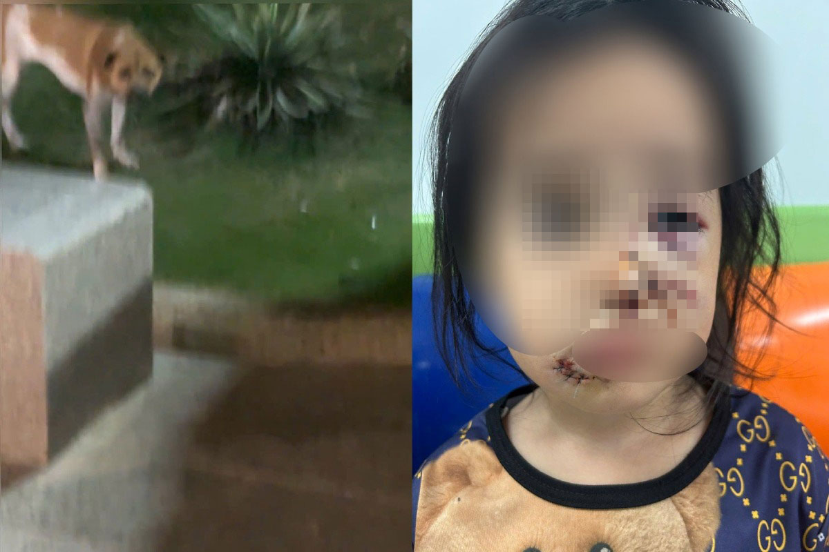 The girl was seriously injured by a dog while playing in the park. Photo: NVCC