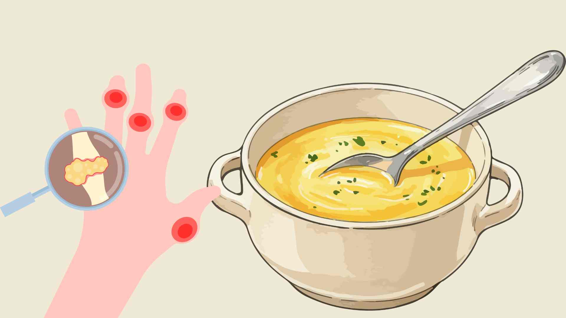 Eating soup properly will not increase uric acid. Graphics: Ha May