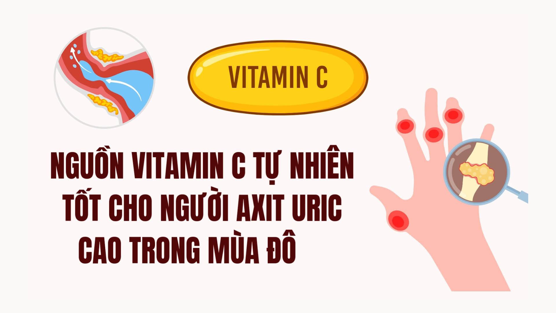 Natural sources of vitamin C are good for people with high uric acid in winter