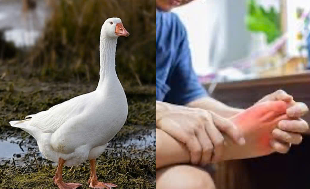 Eating goose meat can increase uric acid. Graphics: Huong Giang