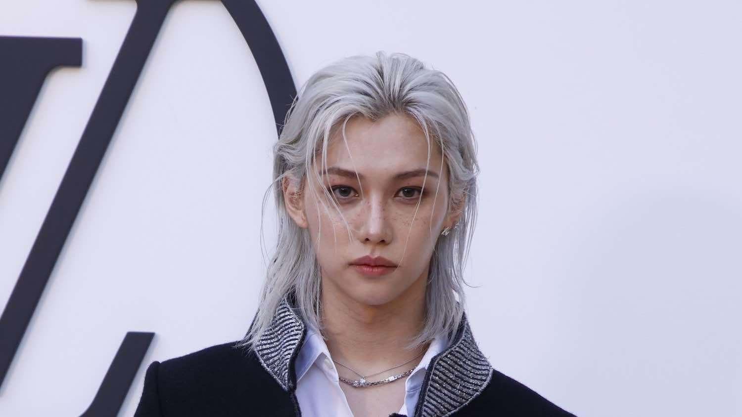 Felix - a member of Stray Kids (in the same company as TWICE) suffered a broken bone after a car accident. Photo: Allkpop