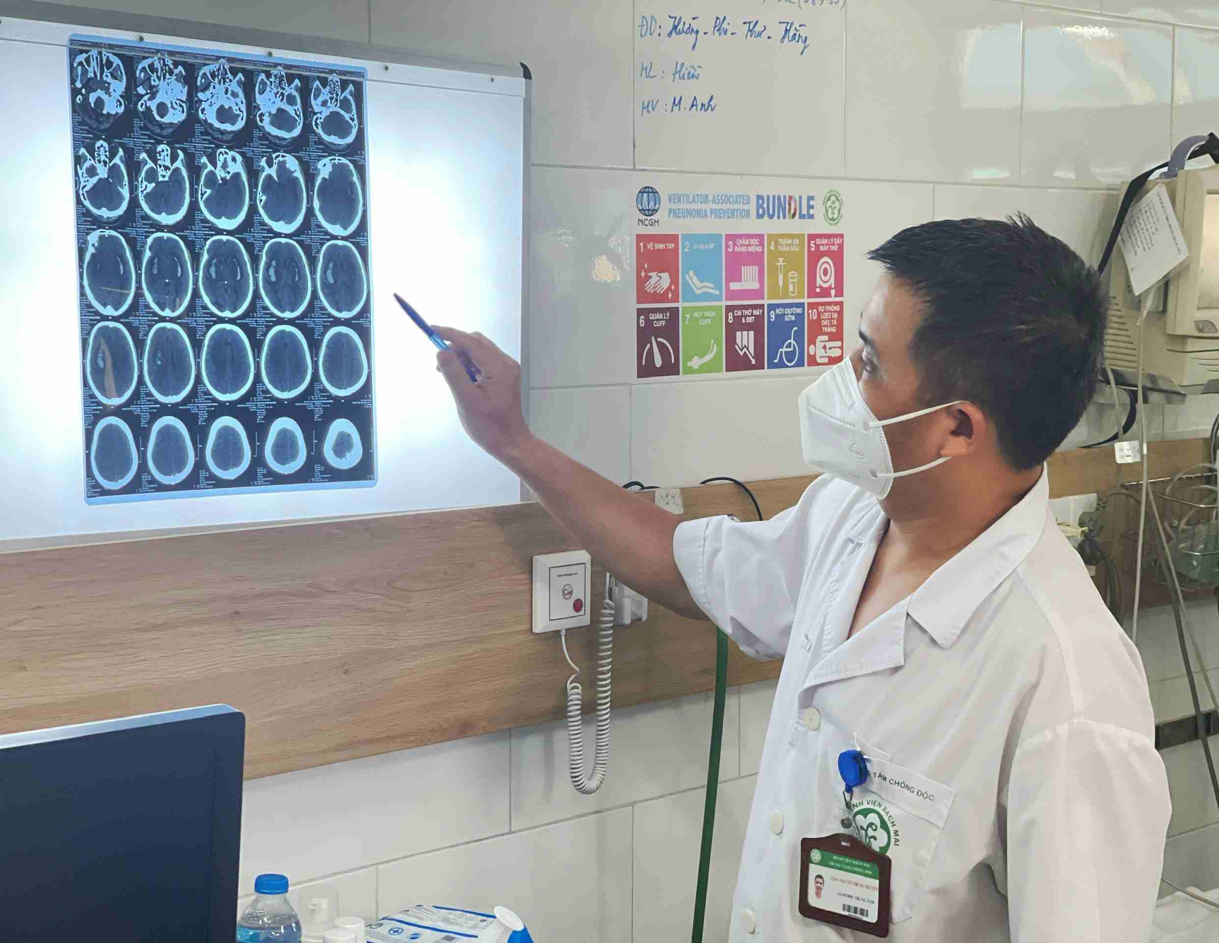 Dr. Nguyen Trung Nguyen pointed out the image of brain damage in a patient poisoned by methanol alcohol. Photo: Thanh Duong