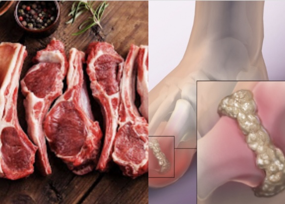 Sheep meat and the risk of increasing uric acid. Graphics: Huong Giang