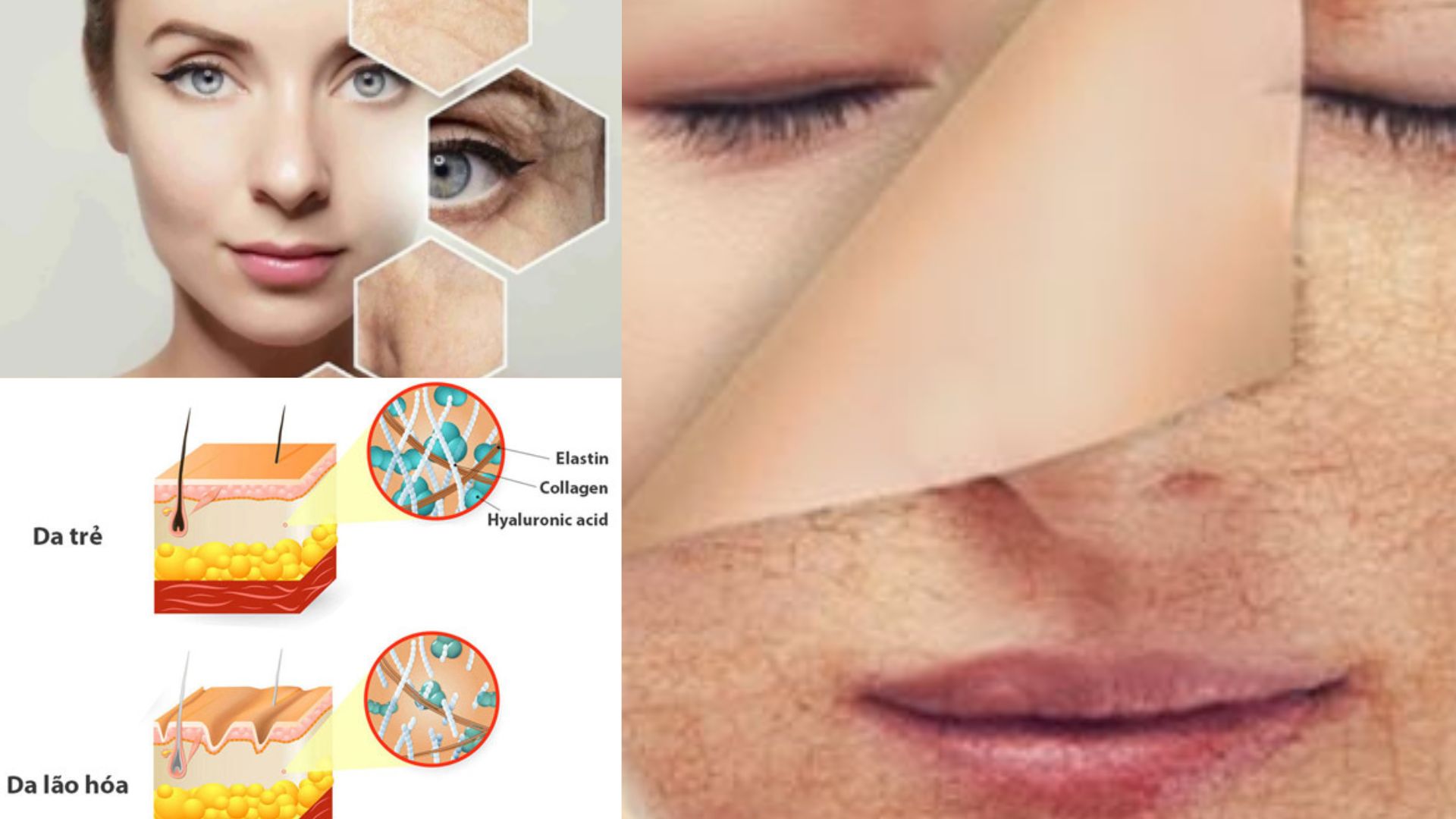 Unexpected age causes collagen degradation accelerates skin aging