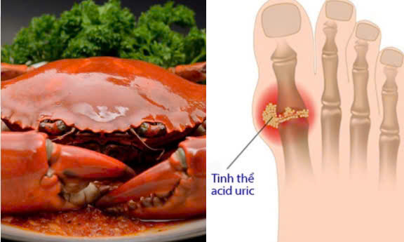 Note when eating crab to avoid increasing uric acid. Graphics: Huong Giang