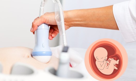 Bộ Y tế yêu cầu xác minh làm rõ vụ việc sản phụ tố bác sĩ tắc trách làm mất con. Ảnh đồ họa: Hương Giang