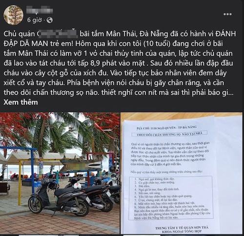 Article by account B.B about his child being assaulted by the owner of the C.C.G coffee shop (Da Nang). Screenshot