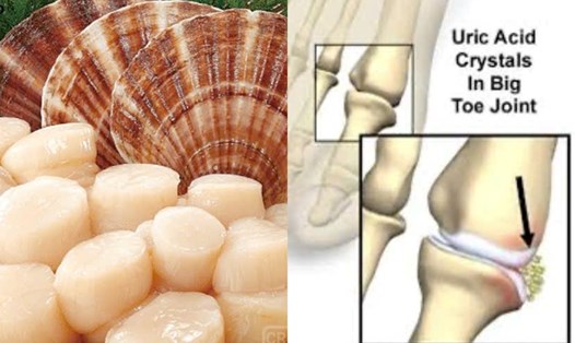 Sò điệp gây nguy cơ tăng axit uric. Đồ họa: Hương Giang