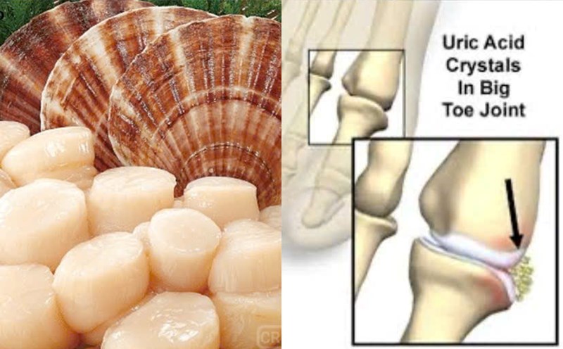 Scallops cause increased risk of uric acid. Graphics: Huong Giang