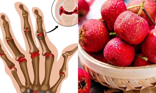 Quả sơn trà giải pháp tự nhiên giúp giảm axit uric. Đồ họa: Hương Giang