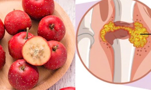 Giảm axit uric và tăng cường sức khỏe với quả sơn trà. Đồ họa: Hương Giang