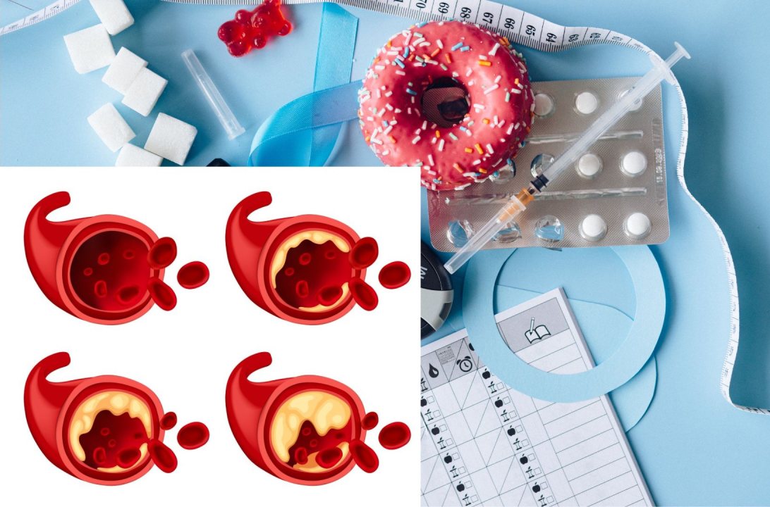 It is necessary to reduce blood fat when the total cholesterol concentration in the blood exceeds 200 mg/dL. Graphic photo: An Tu