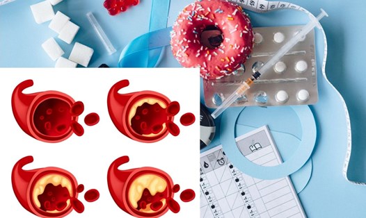 Cần giảm mỡ máu khi nồng độ cholesterol toàn phần trong máu vượt quá 200 mg/dL. Ảnh đồ họa: An Tú