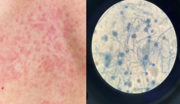 Mushrooms - the cause of death of more than 4 million people each year. Graphics: Huong Giang