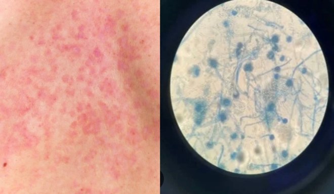 Mushrooms - the cause of death of more than 4 million people each year. Graphics: Huong Giang