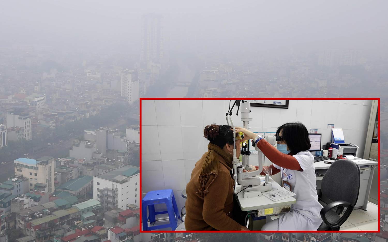 Continuous air pollution, doctors warn of eye damage