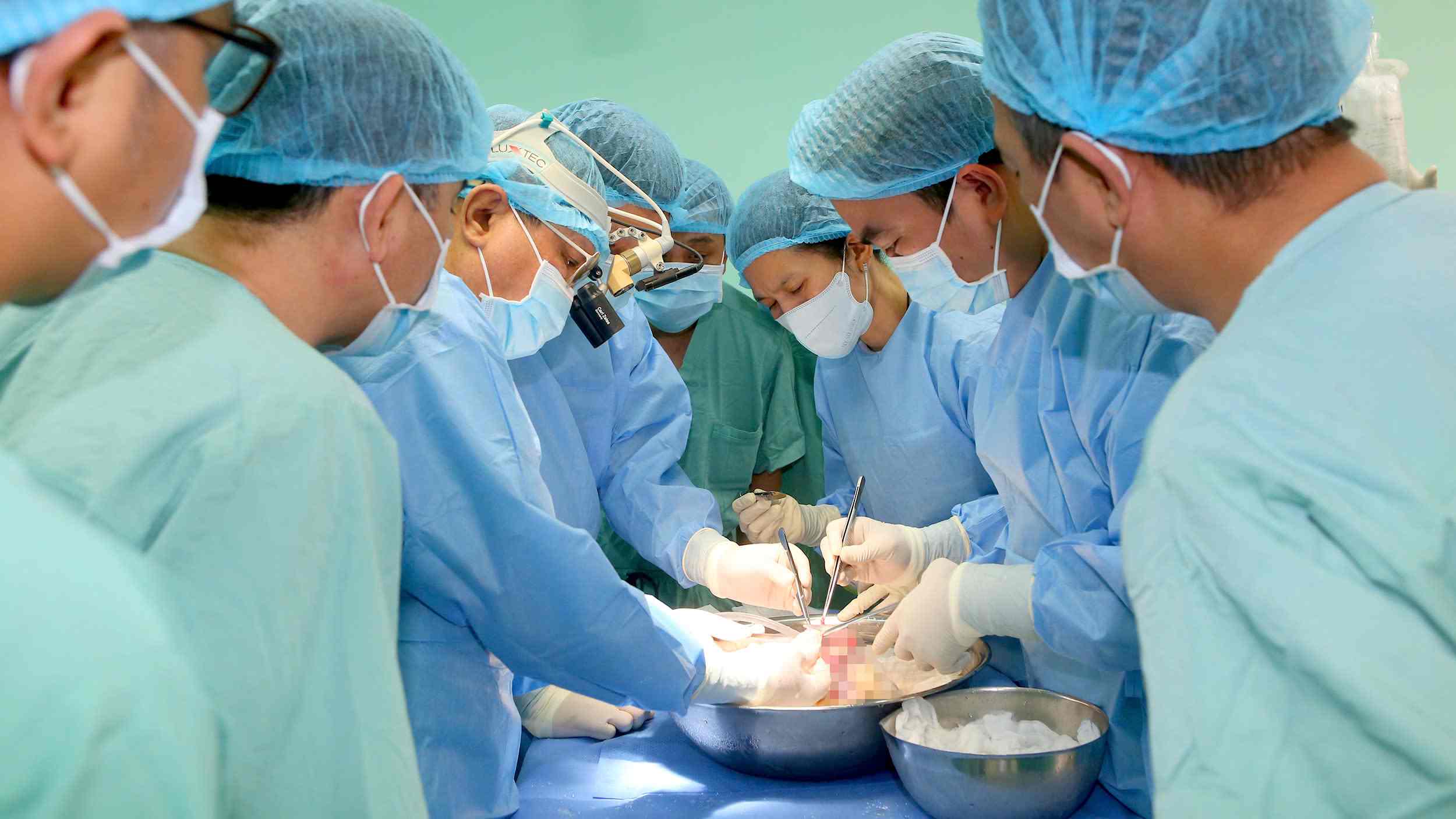 Doctors perform a heart transplant. Photo: Lan Huong.