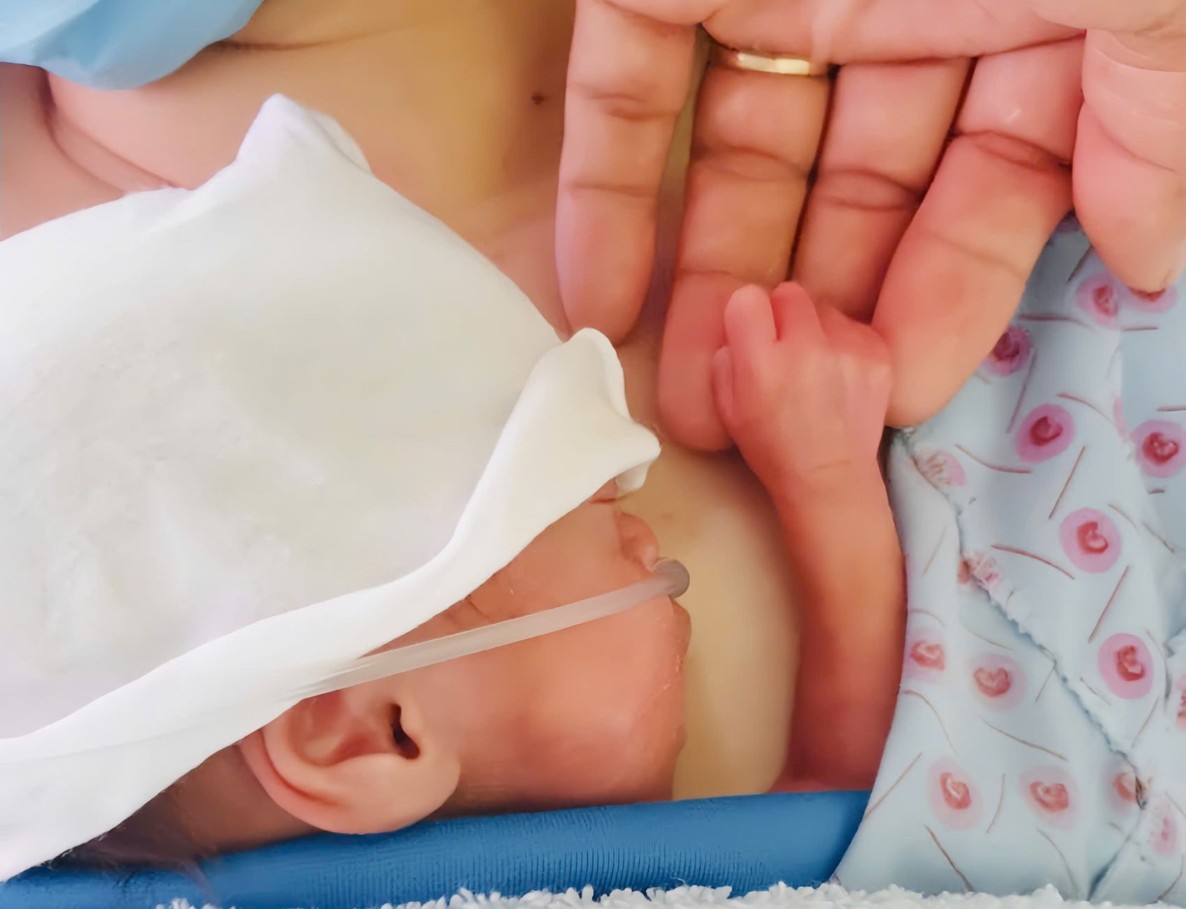 The twins were born extremely prematurely at 26.3 weeks. Photo: BVCC