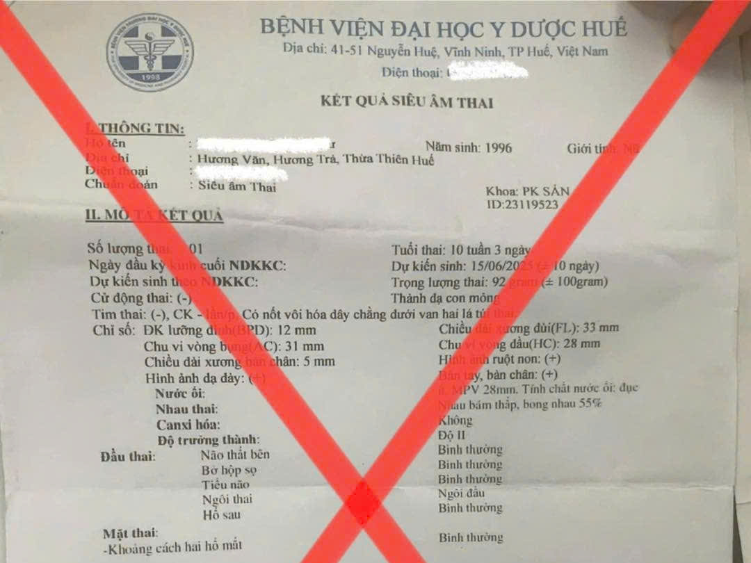 Fake ultrasound result form from Hue University of Medicine and Pharmacy Hospital. Photo: Quang An.