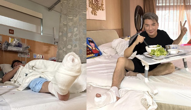 Dam Vinh Hung had an accident in the US. Photo: Artist provided.