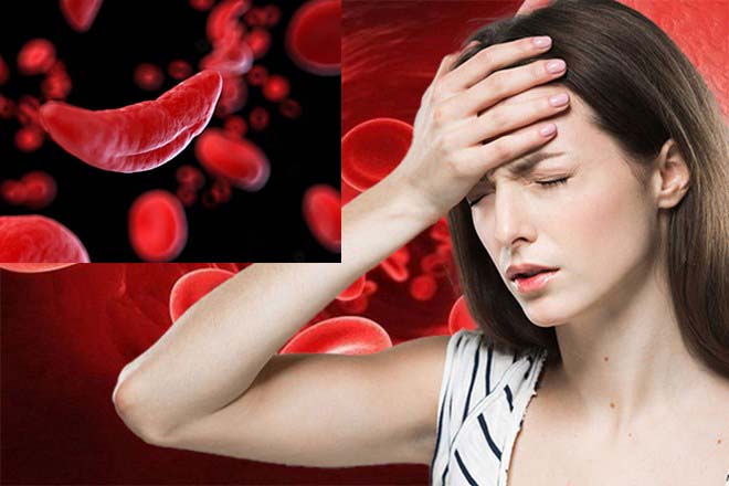 Sickle red blood cell disease is a genetic disorder of blood. Graphic: Ngoc Thuy