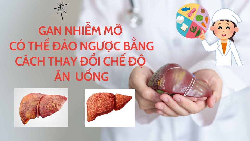 Fatty liver can be reversed by changing the diet