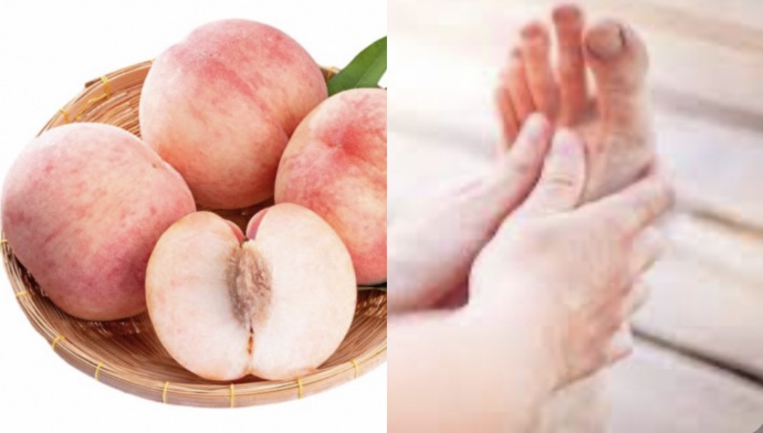 Note when eating peaches so as not to cause hyperuricemia quickly. Graphics: Huong Giang