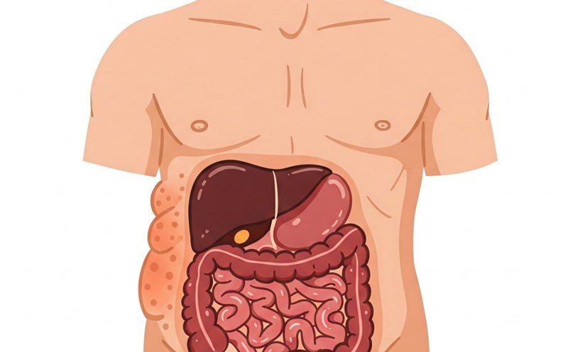 High visceral fat can lead to chronic diseases such as high blood pressure and cancer. Photo: AI