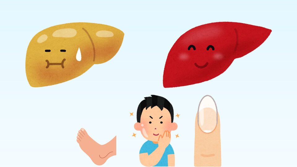 Common signs of affected liver health. Graphics: Minh Chau