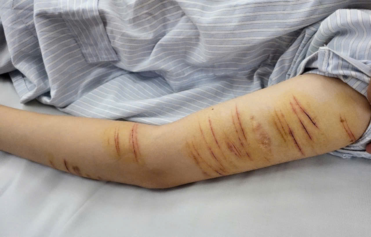 Image of children causing injuries themselves going to the Institute of Mental Health for treatment. Photo: BVCC