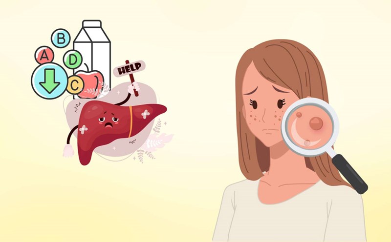 parts of the body that report liver health